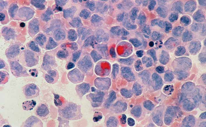 Rising Geriatric Population Accelerating Demand for Neuroinflammation Therapies.